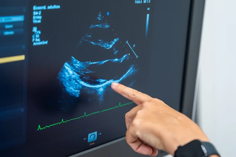 ecografia servizio di diagnostica per immagini terme santa lucia tolentino